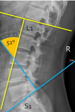 <p>Q what is the name of this measurement? and what is the average + range?</p>