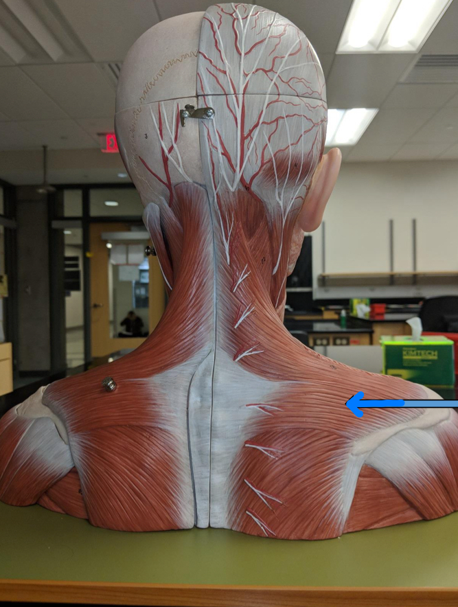 <p>Identify this muscle?</p>