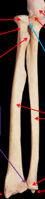 <p>What is the blue arrow pointing to? </p>