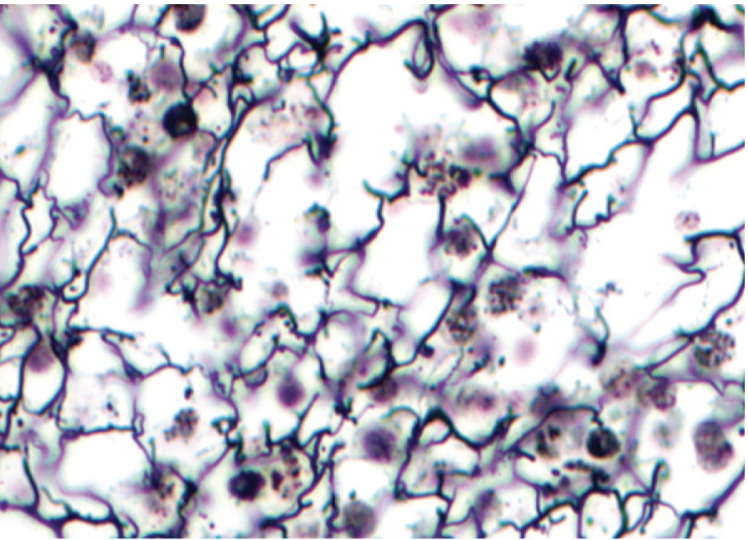 <p>Reticular Tissue</p>