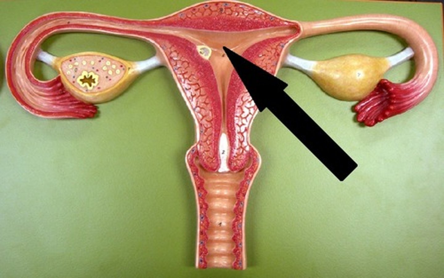 <p>name this SPACE</p>