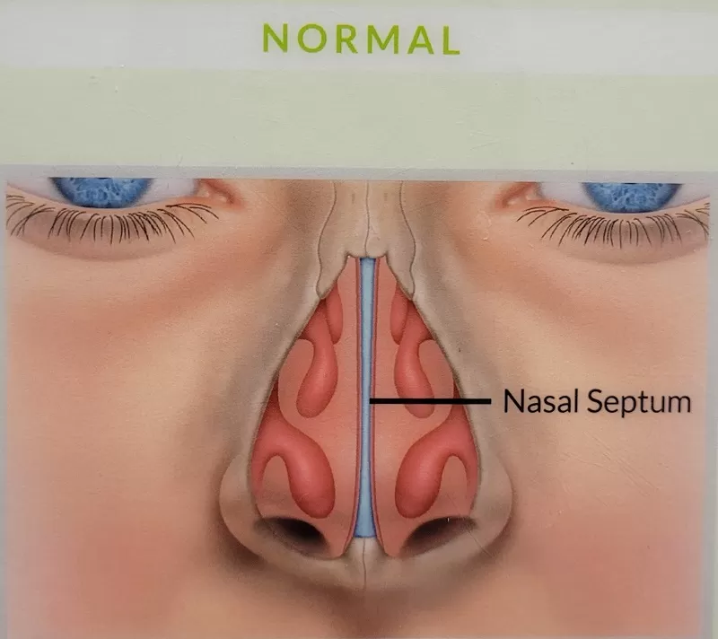 <p>wall of cartilage and bone that divides the nasal cavity into two halfs</p>