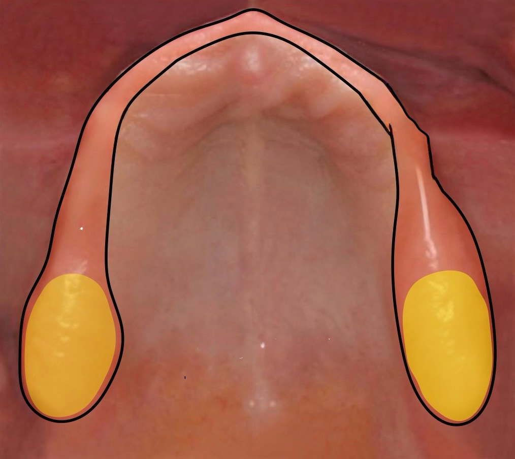 <p>what structure is highlighted in yellow?</p>