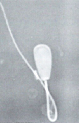 <p>What is wrong with this sperm?</p>
