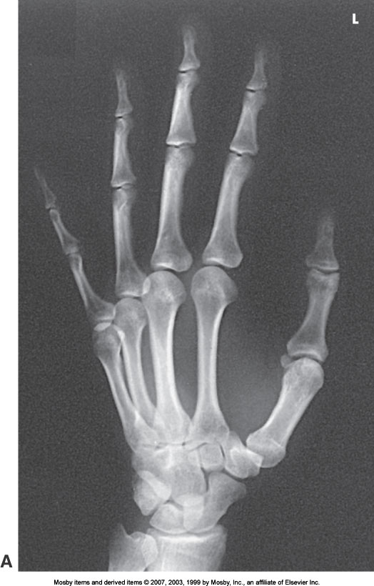 <p>What position is demonstrated?</p>