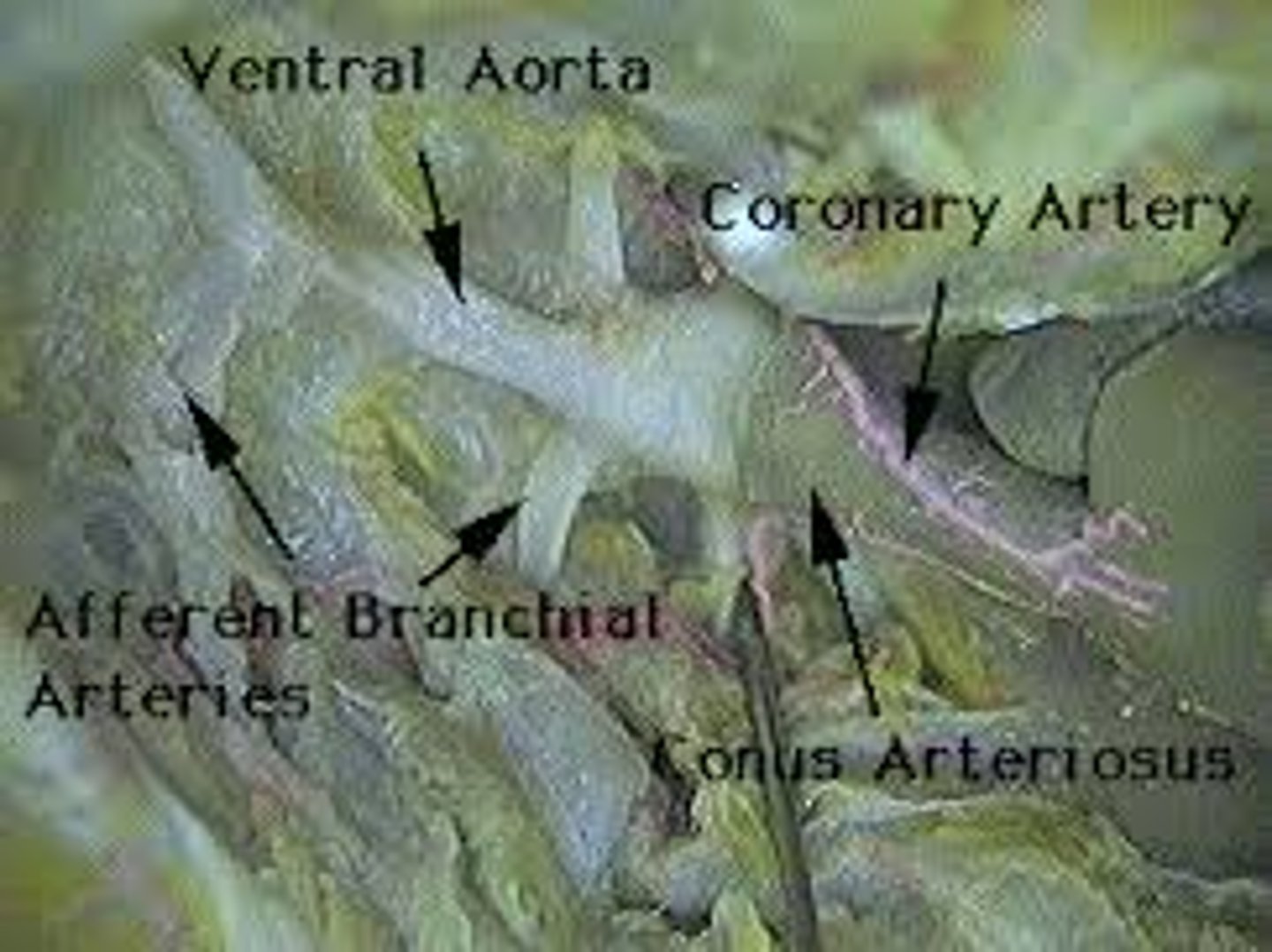 <p>large blood vessel of heart that branches into smaller vessels</p>