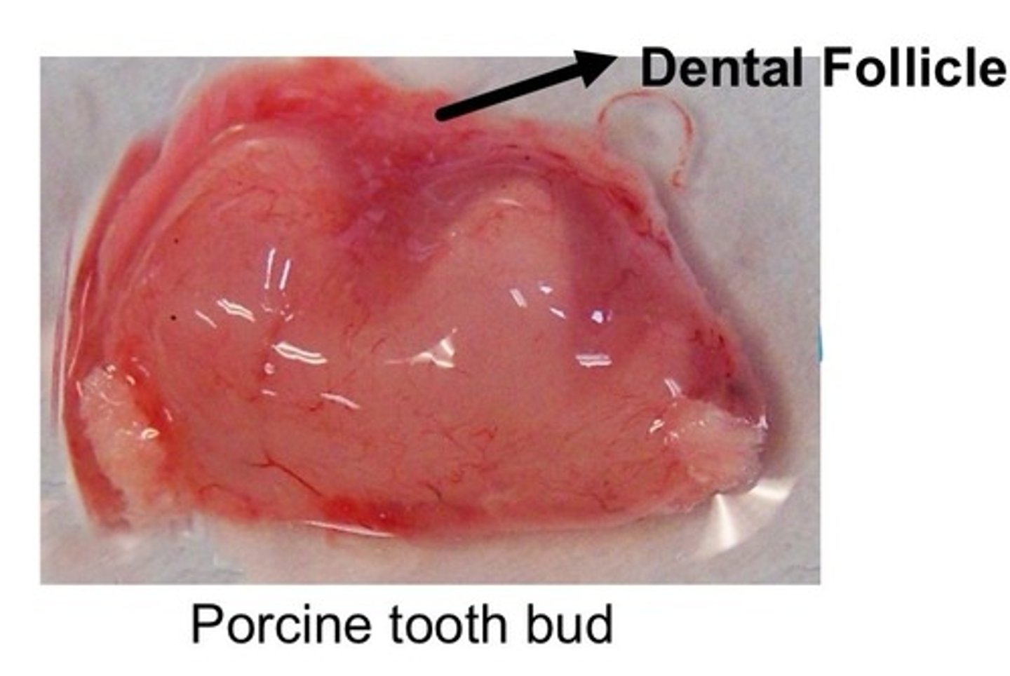 <p>ectomesenchymal cell condensation that harbors heterogeneous population of cells that make up the periodontium (a bunch of different types of stem cells that will make up all the different types of cells of future periodontium)</p>