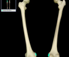 <p><span>projection above medial condyle of femur</span></p>