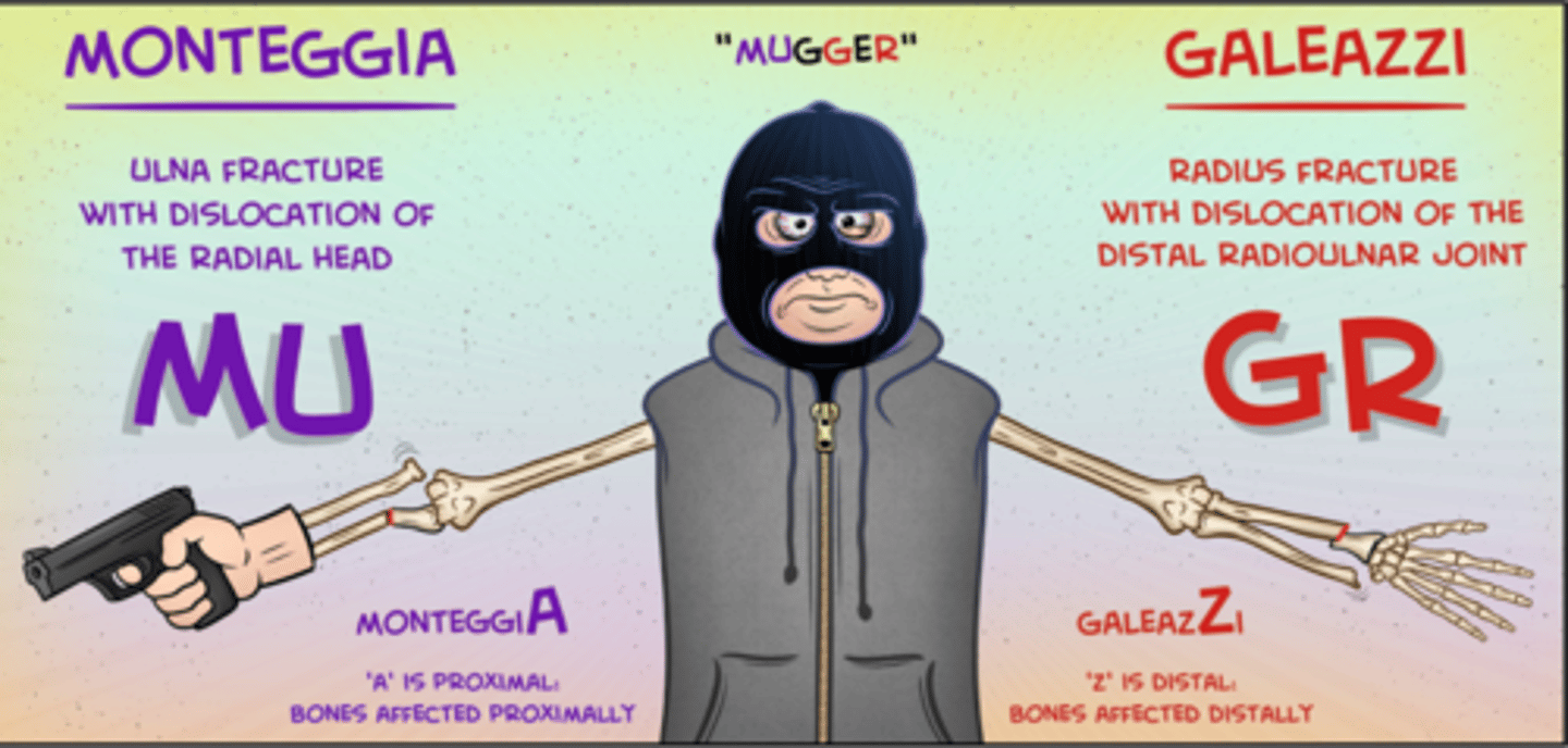 <p>monteggia fracture</p>