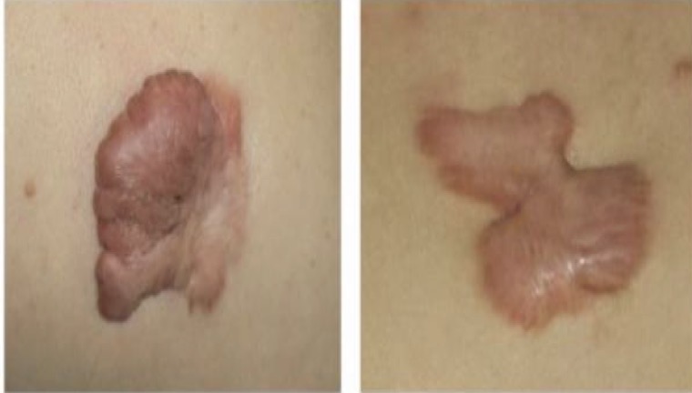 <p>A- identify</p><p>B- describe</p>