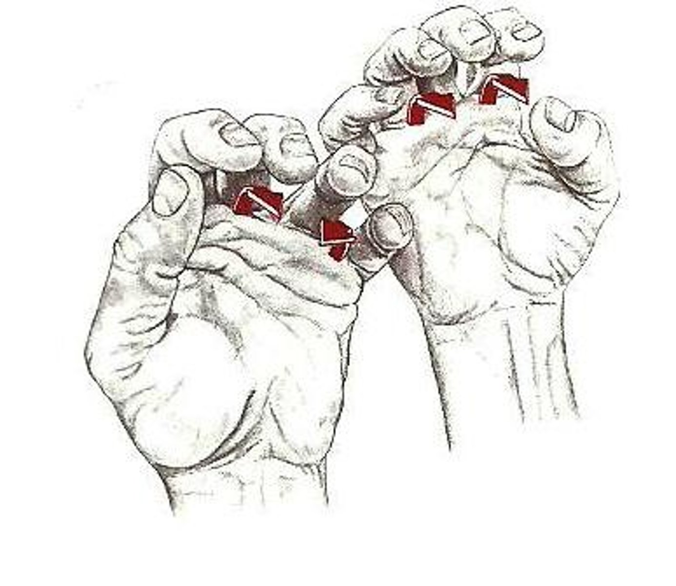 <p>interphalageal</p>