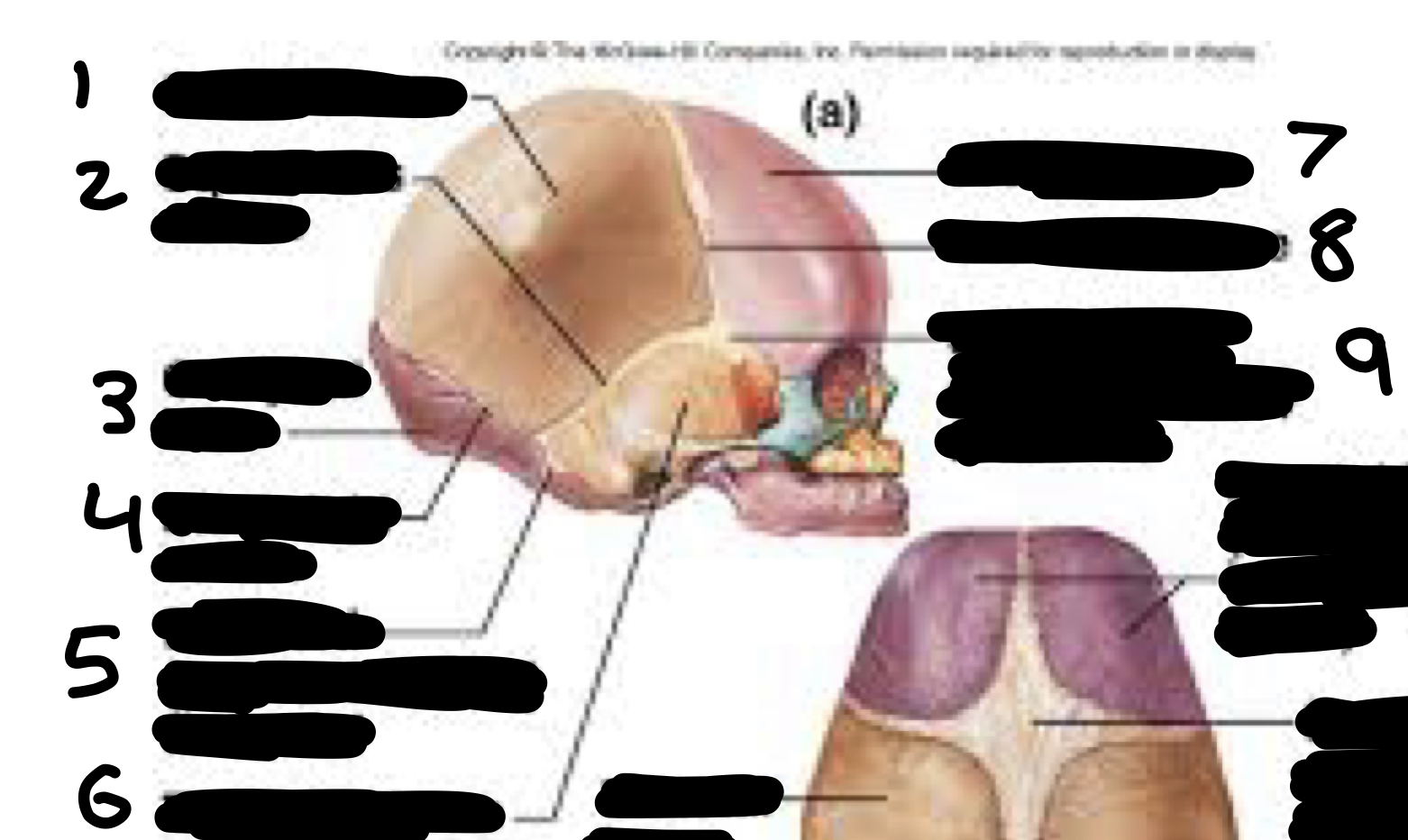 <ol><li><p>parietal bone</p></li><li><p>squamous suture</p></li><li><p>occipital bone</p></li><li><p>lambdoid suture</p></li><li><p>mastoid (posterolateral) fontanel</p></li><li><p>temporal bone</p></li><li><p>frontal bone</p></li><li><p>coronal suture</p></li><li><p>sphenoidal (anterolateral) fontanel</p></li></ol>