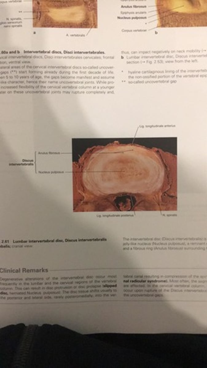 <p>Nucleus pulposus</p>
