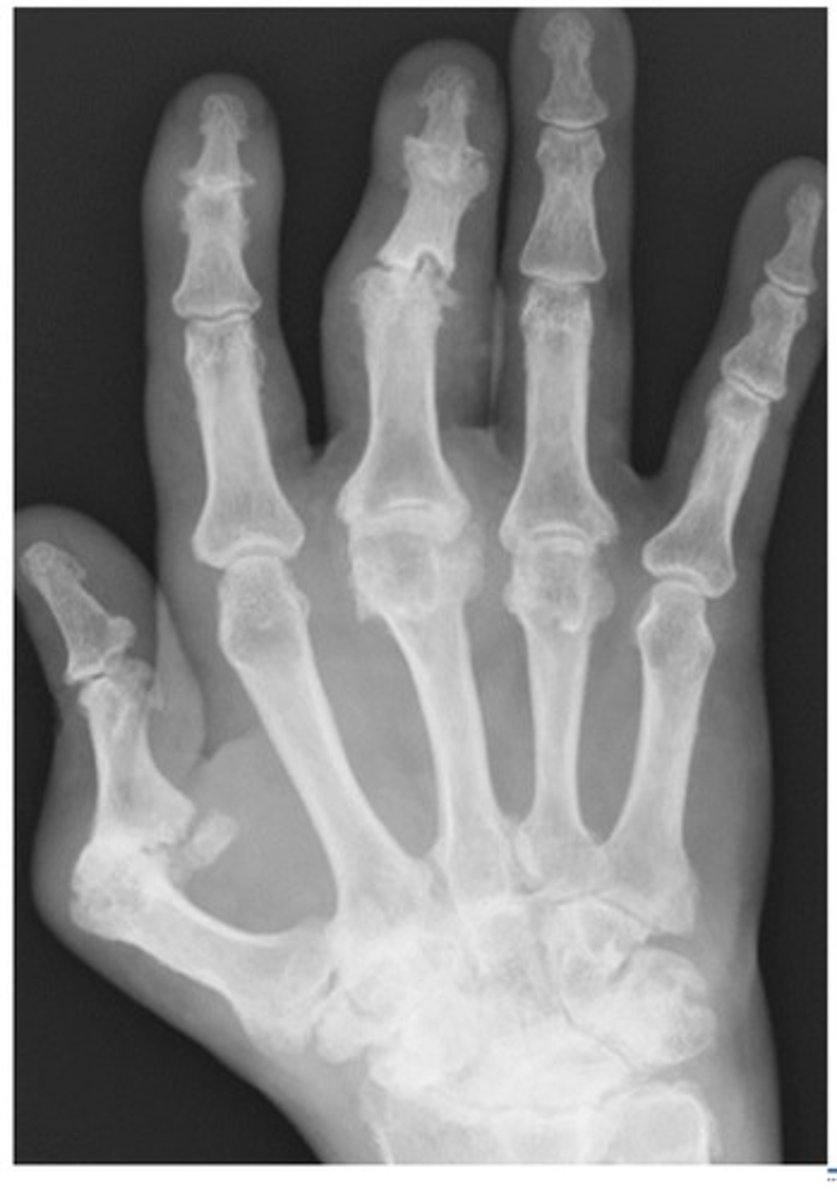 <p>What diagnosis is this?</p>