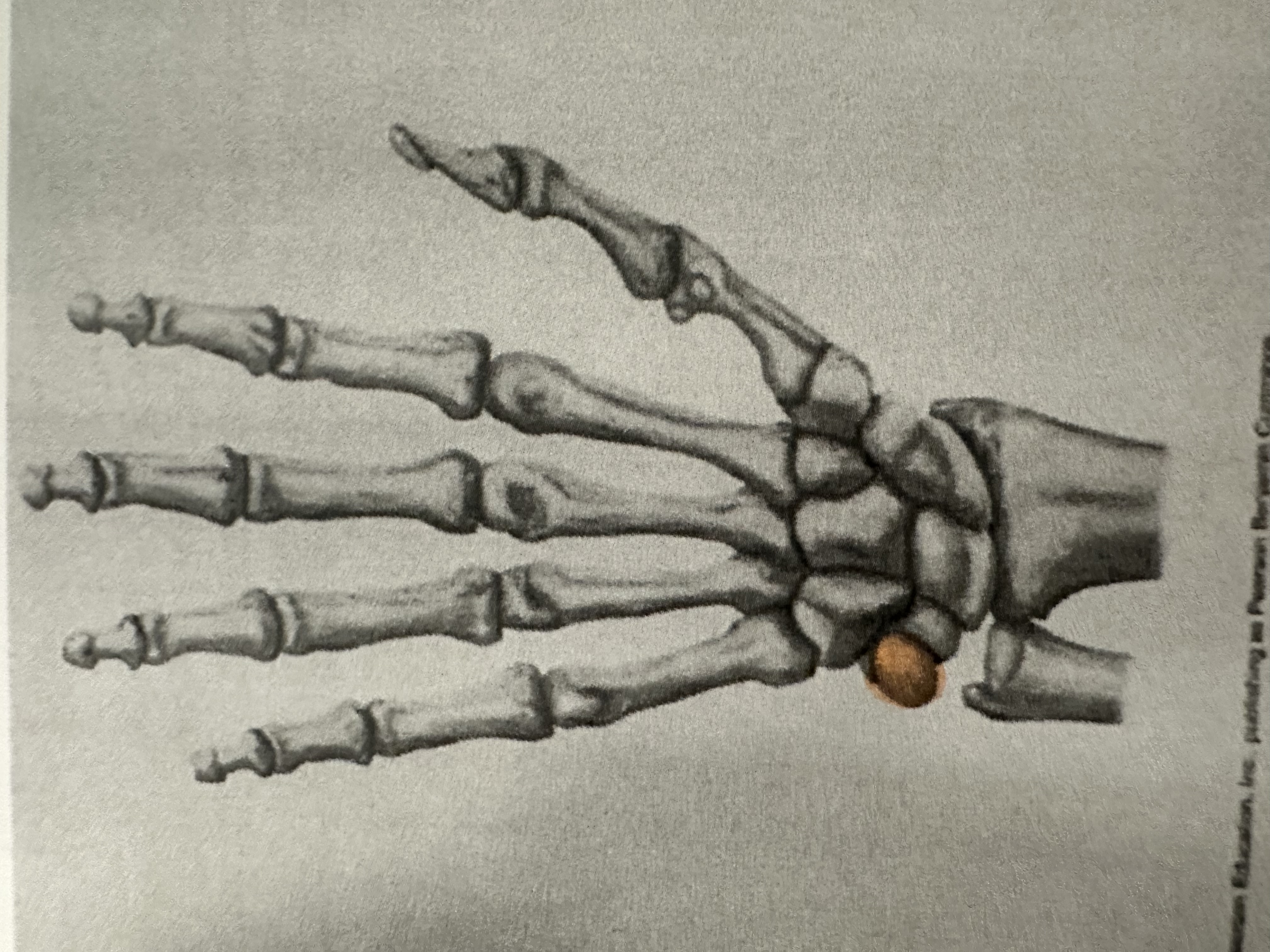 <p>Proximal Carpal Bone</p>