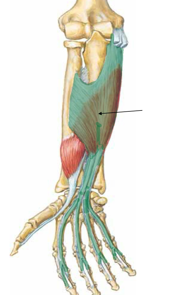 <p>What muscle is indicated?</p>