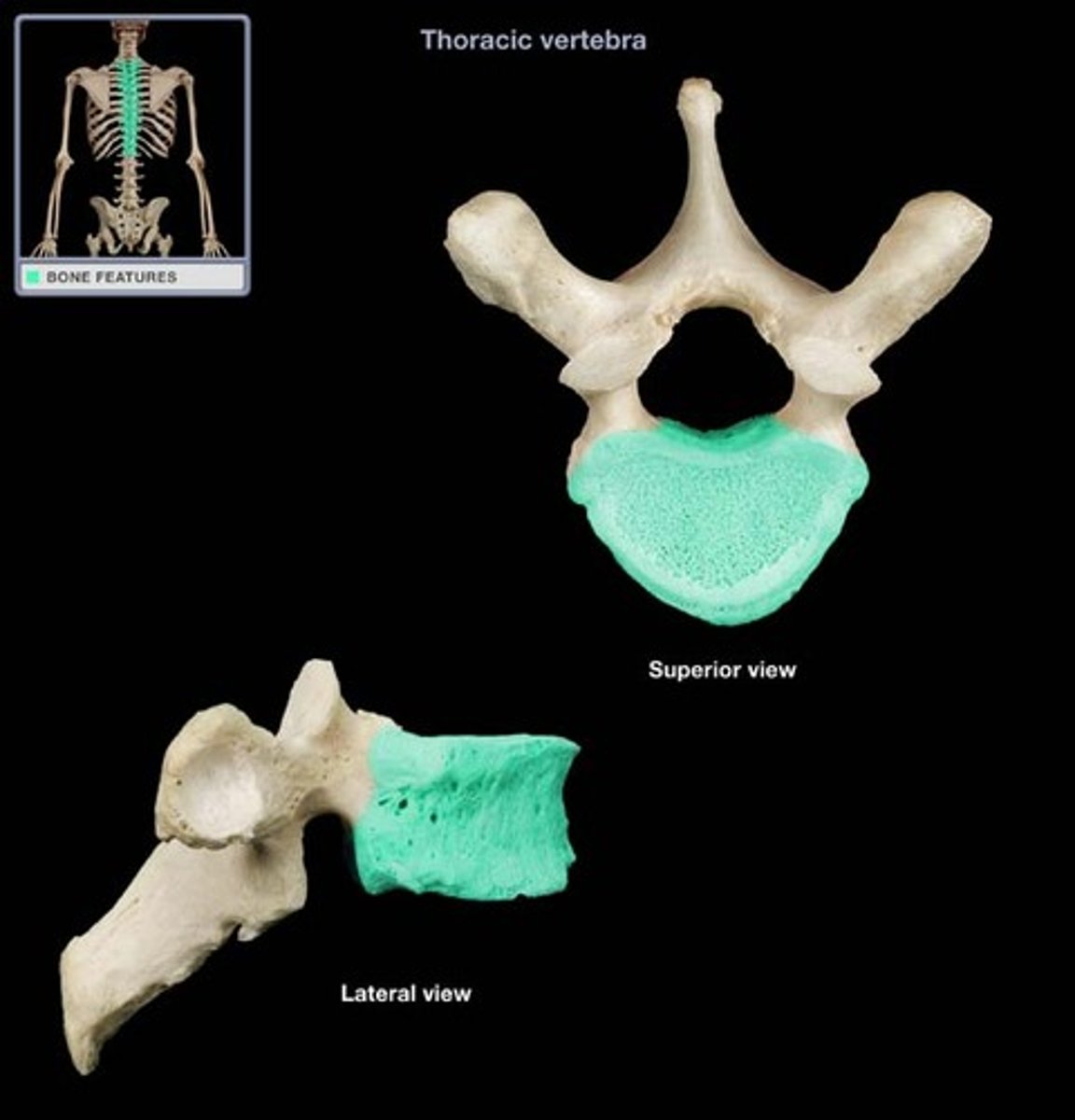 <p>Rounded central portion of the vertebra, which faces anteriorly in the human vertebral column</p>