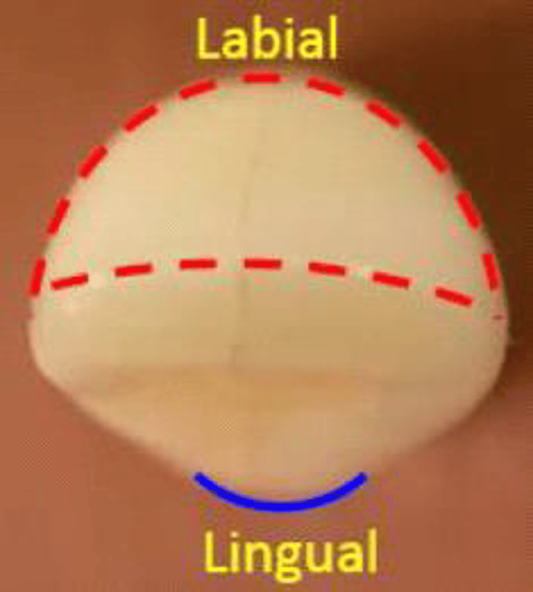 <p>what tooth is this?</p>
