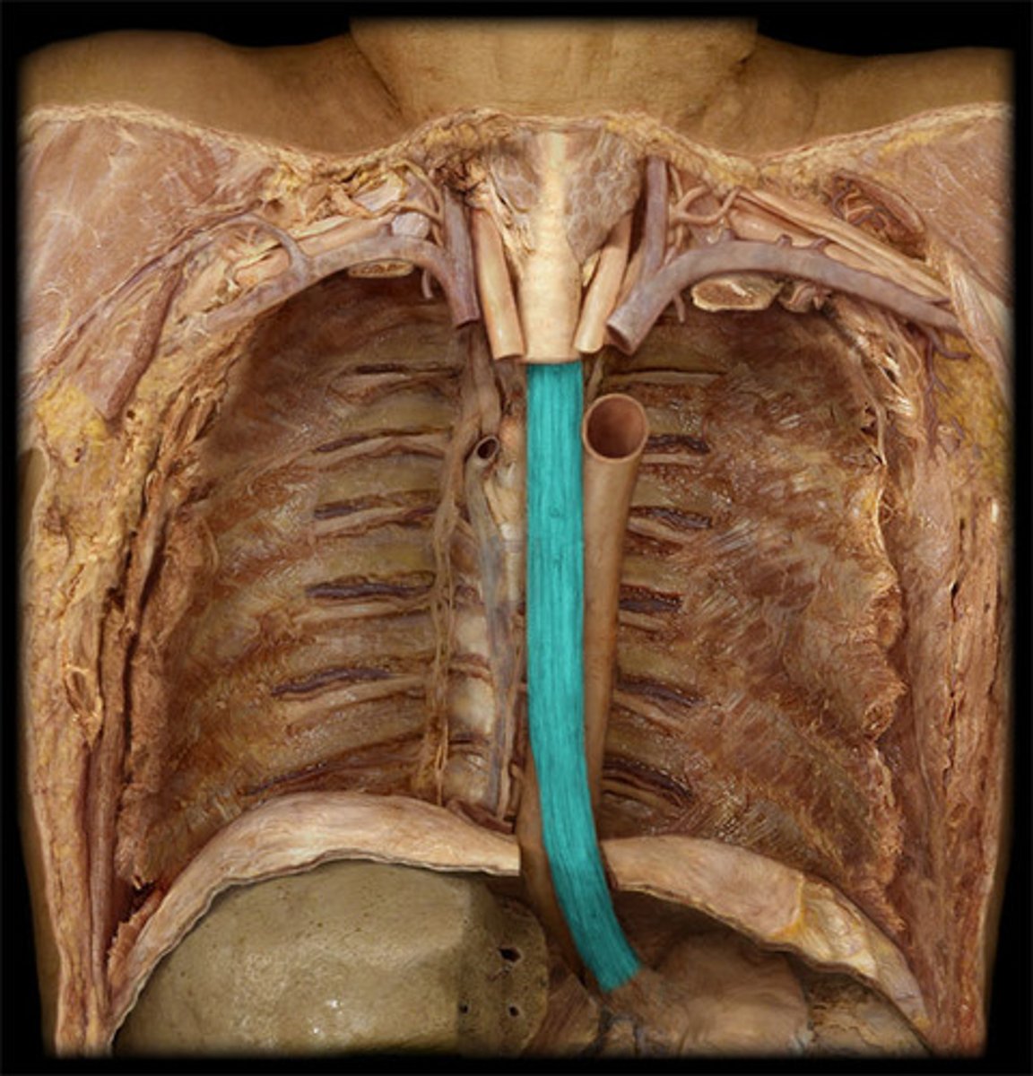 <p>The portion of the esophagus located in the thoracic cavity.</p>
