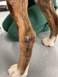 <p>Single raised pink nodule on head, trunk or limbs</p>