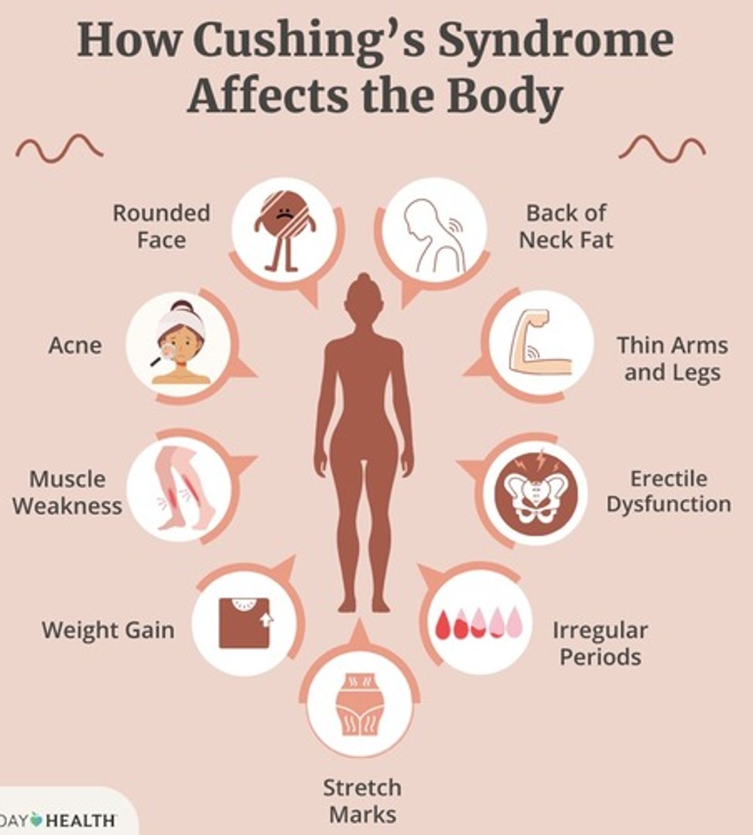 <p>Cushing's syndrome</p>