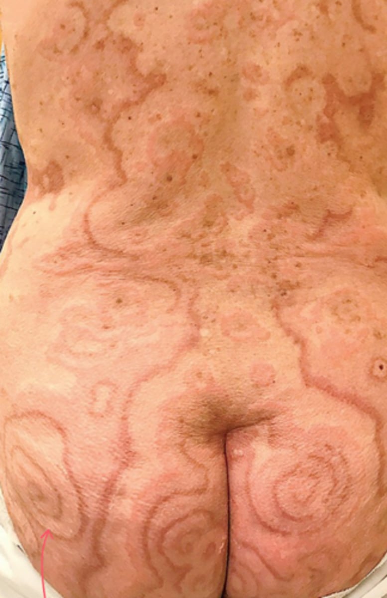 <p>What is the diagnosis?</p>