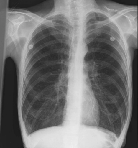 <p>What is this pathology?</p>