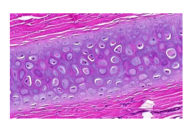 <p>what type of cartilage is this </p>