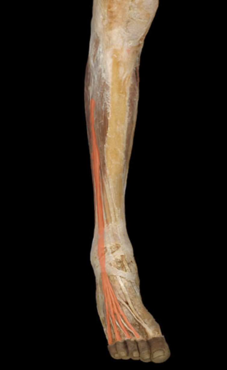 term image