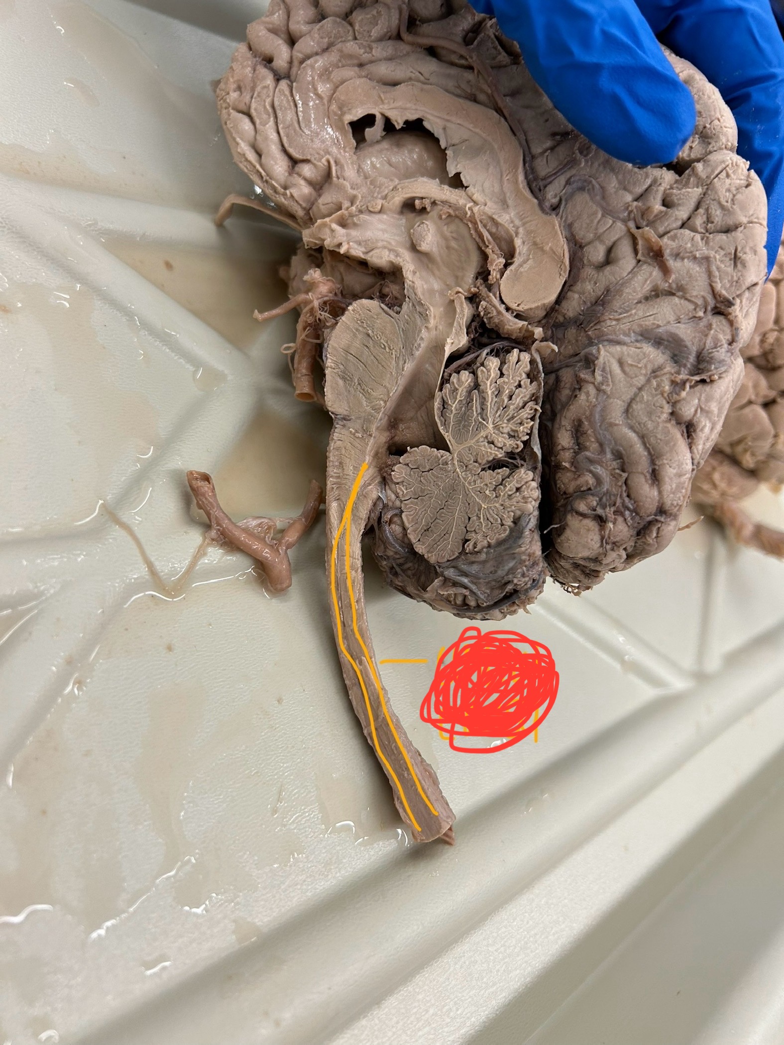 <p>What is this showing?</p>