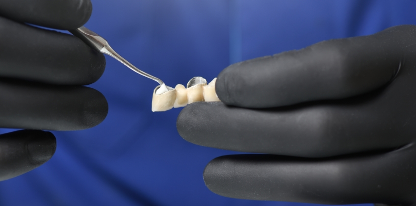 <p>A dental cement used to glue a restoration (like a crown or inlay) to a tooth.</p><p></p><p>Holds restorations in place</p>