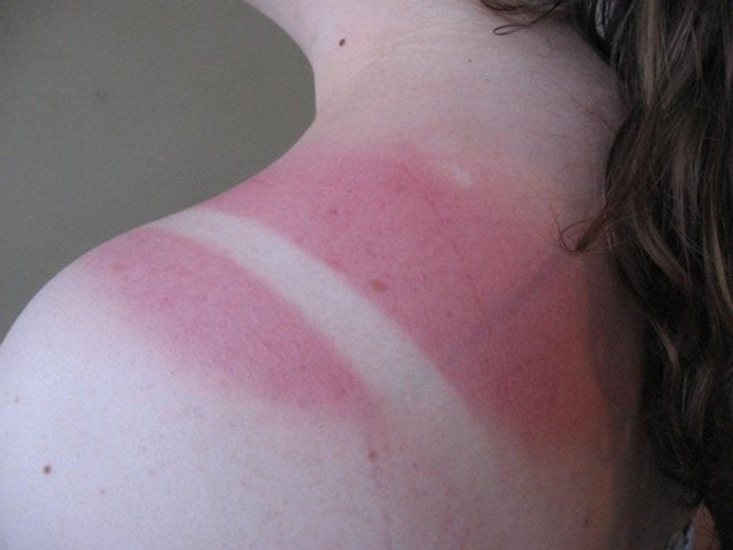 <p>red-skinned because you were in the sun too much</p>