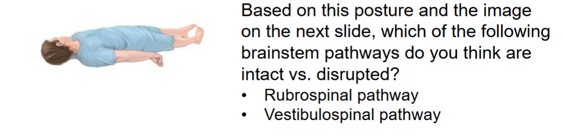 <p>Posturing and pathway effects</p>