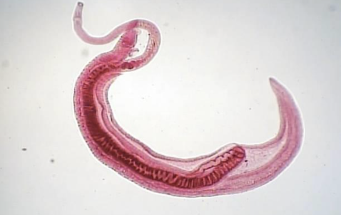 <p>Schistosoma mansoni </p>