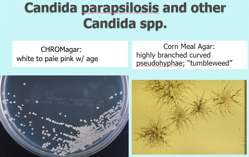 <p>chrom: white to pink w age</p><p>CMA: highly branched curved pseudohyphae; “tumbleweed”</p>
