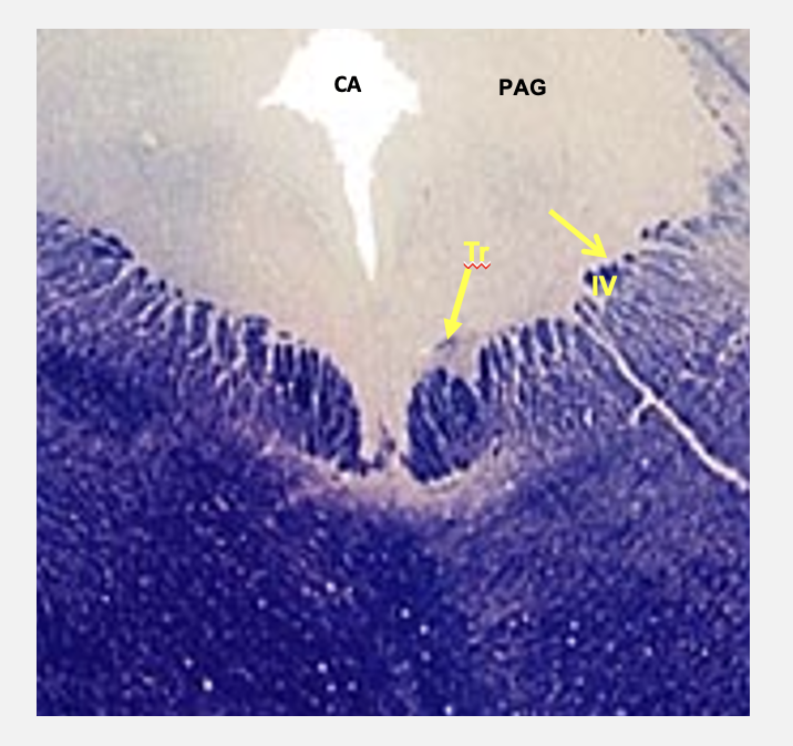 <p>located in caudal midbrain; troclear nerve is the only cranial nerve that exits from dorsal aspect of brain; also only cranial nerve that crosses to innervate contralateral muscle </p>