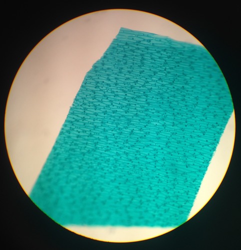 Dicot leaf has a thin layer of cuticle on both the upper and lower epidermis, whereas monocot leaf has thick cuticle on the upper epidermis and thin on the lower epidermis