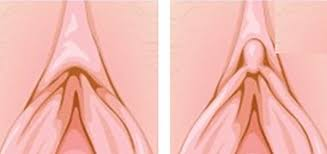<p><span style="color: blue"><strong>ciltoral hood</strong></span></p><p><span style="color: #000000">( loose skin covering head of ciltorus ) </span></p>