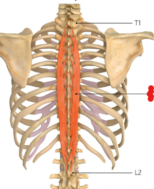 <p>Origin: Spinous processes of vertebrae T11-L2</p><p>Insertions: Spinous processes of the upper thoracic vertebrae by 4-8 tendons</p><p>Innervation: Dorsal rami of the upper cervical nerves</p><p>Action: Extension and lateral flexion of the spine</p>
