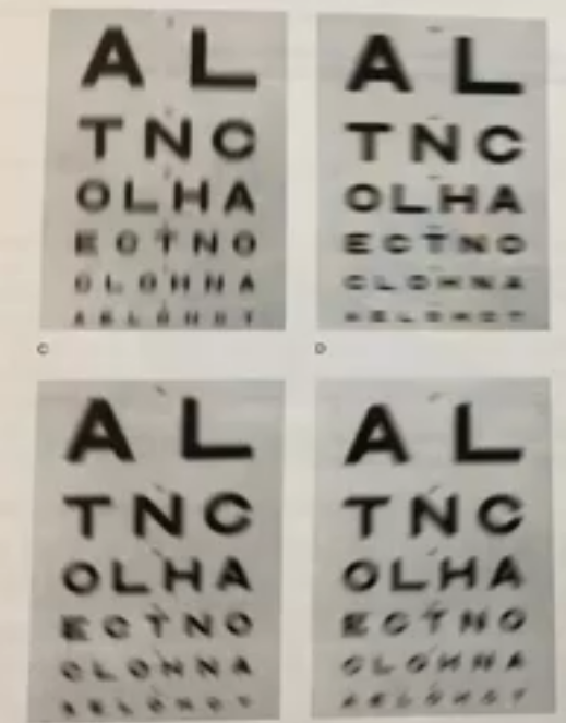 <p>astigmatic defocus when the cyl axis is not H or V&nbsp;</p>