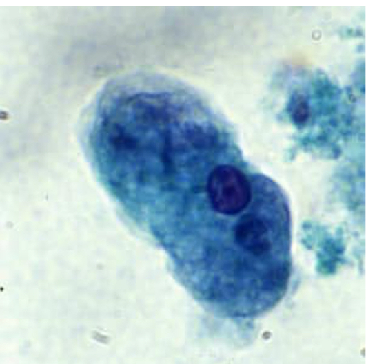 <p>E histolytica trophozoite</p>