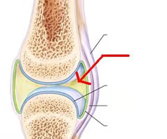two bones are separated by a synovial cavity, lined by a synovial membrane & filled with synovial fluid

\
