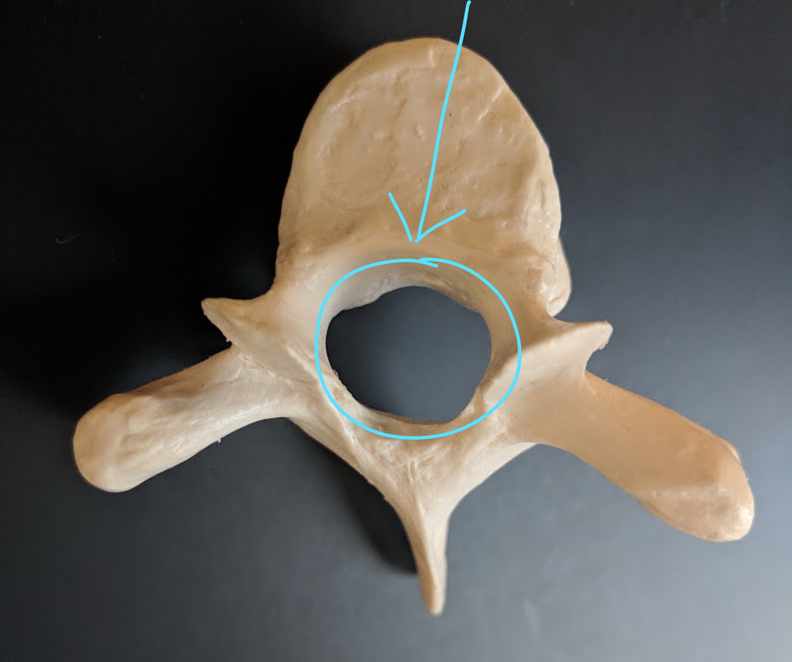 <p>Name this structure </p>