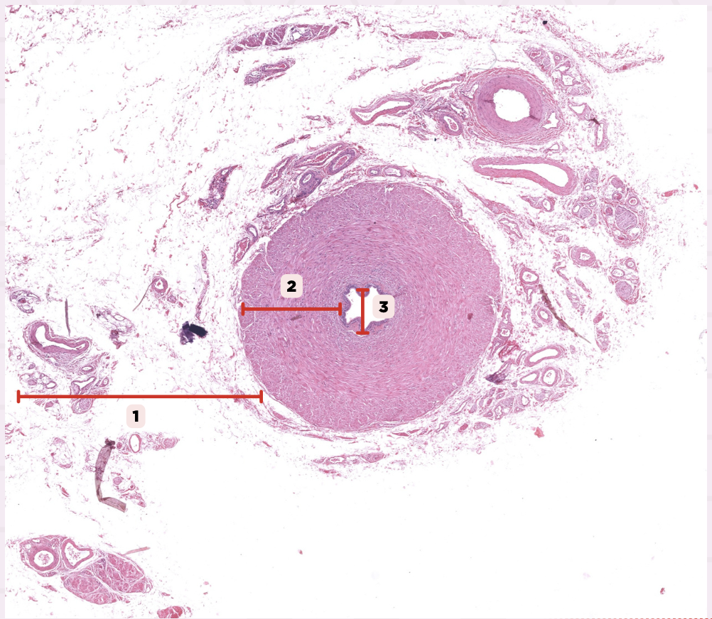 <p>Identify the structure labeled as 3.</p>