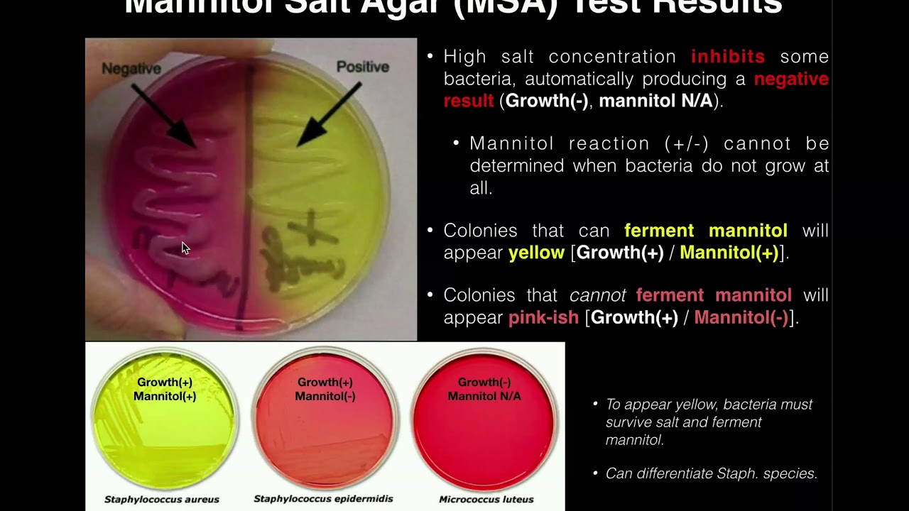 <p>On MSA, Staph aureus (ferments mannitol) appear yellow while Coag negative staph (does not ferment mannitol) appear red.</p>