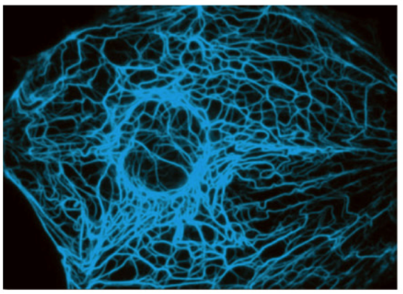 intermediate filaments