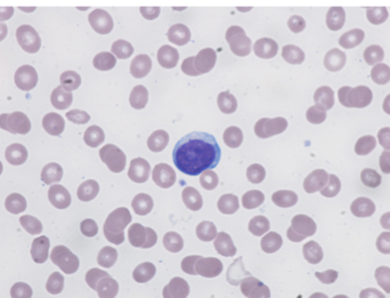 <p>Diagnostics for ALL</p>