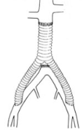 <p>AO to distal iliac or CFA (bilaterally)</p><p>to bypass distal AO</p><p>to bypass iliac artery disease <strong>mc</strong></p>
