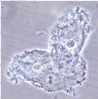 term image
