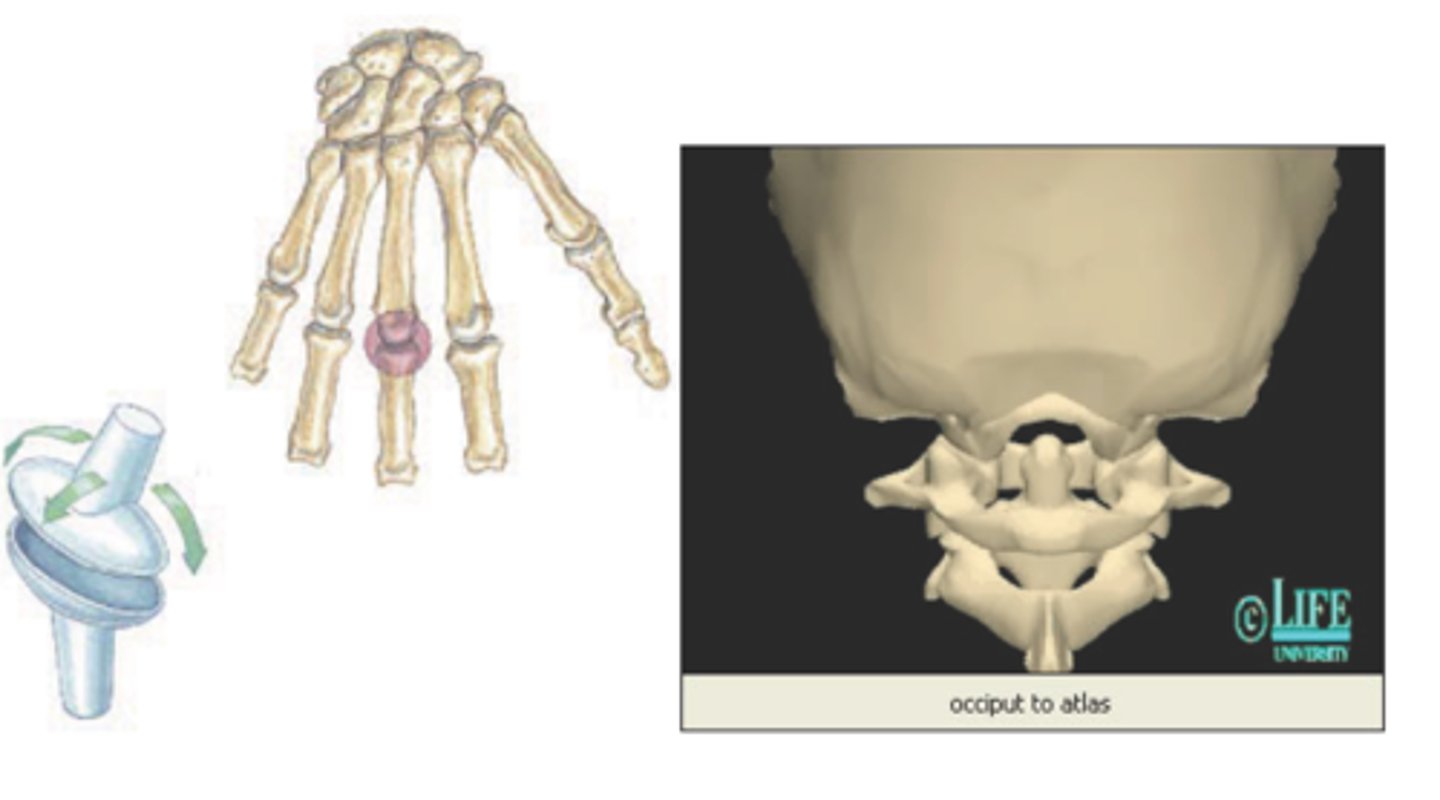 <p>What type of joint is this?</p>